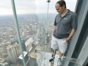 motorcycle accident bionic leg